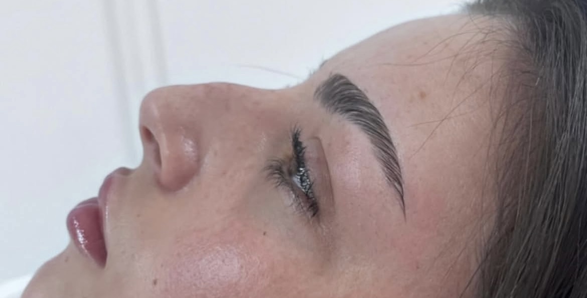 Rhinoplasty before treatment